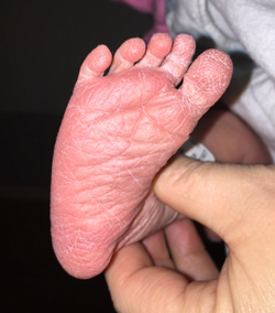 Adoption – December 31, 2014 Foot 20141231