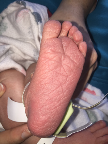 Adoption – August 28, 2015 Foot_20150828