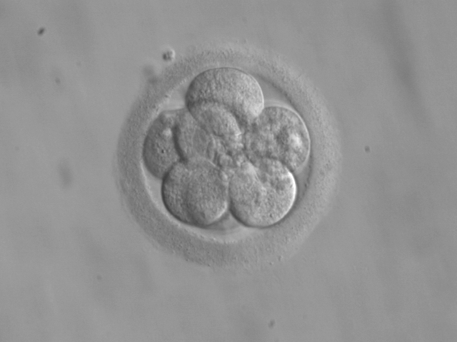 Assisted Reproductive Technologies, AKA Surrogacy, are on the rise Embryo,_8_cells
